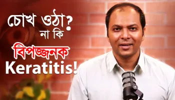 চোখ ওঠা মনে করছেন? হতে পারে বিপজ্জনক Keratitis!