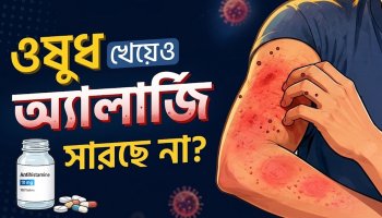 বেগুন খেলেই কি সারা শরীর চুলকায়? অ্যালার্জির কারণ, লক্ষণ ও প্রতিকার |