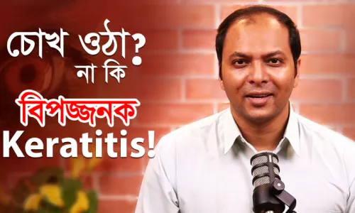 চোখ ওঠা মনে করছেন? হতে পারে বিপজ্জনক Keratitis!