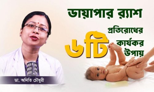 ৬টি মারাত্মক ভুলেই হচ্ছে বাচ্চার ডায়াপার র‍্যাশ! সমাধান জানুন এখুনি!