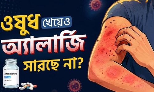 বেগুন খেলেই কি সারা শরীর চুলকায়? অ্যালার্জির কারণ, লক্ষণ ও প্রতিকার |