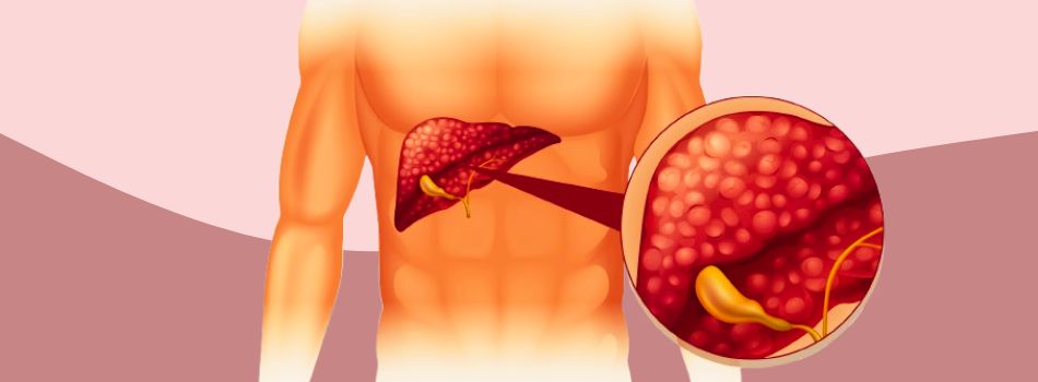 লিভার ড্যামেজের ৯ লক্ষণ, যা ৯০% মানুষ এড়িয়ে যায়!_image