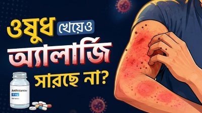 বেগুন খেলেই কি সারা শরীর চুলকায়? অ্যালার্জির কারণ, লক্ষণ ও প্রতিকার |